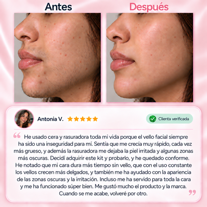 CORLEN beauty™ Kit Trilogía Depilación Facial 3 en 1