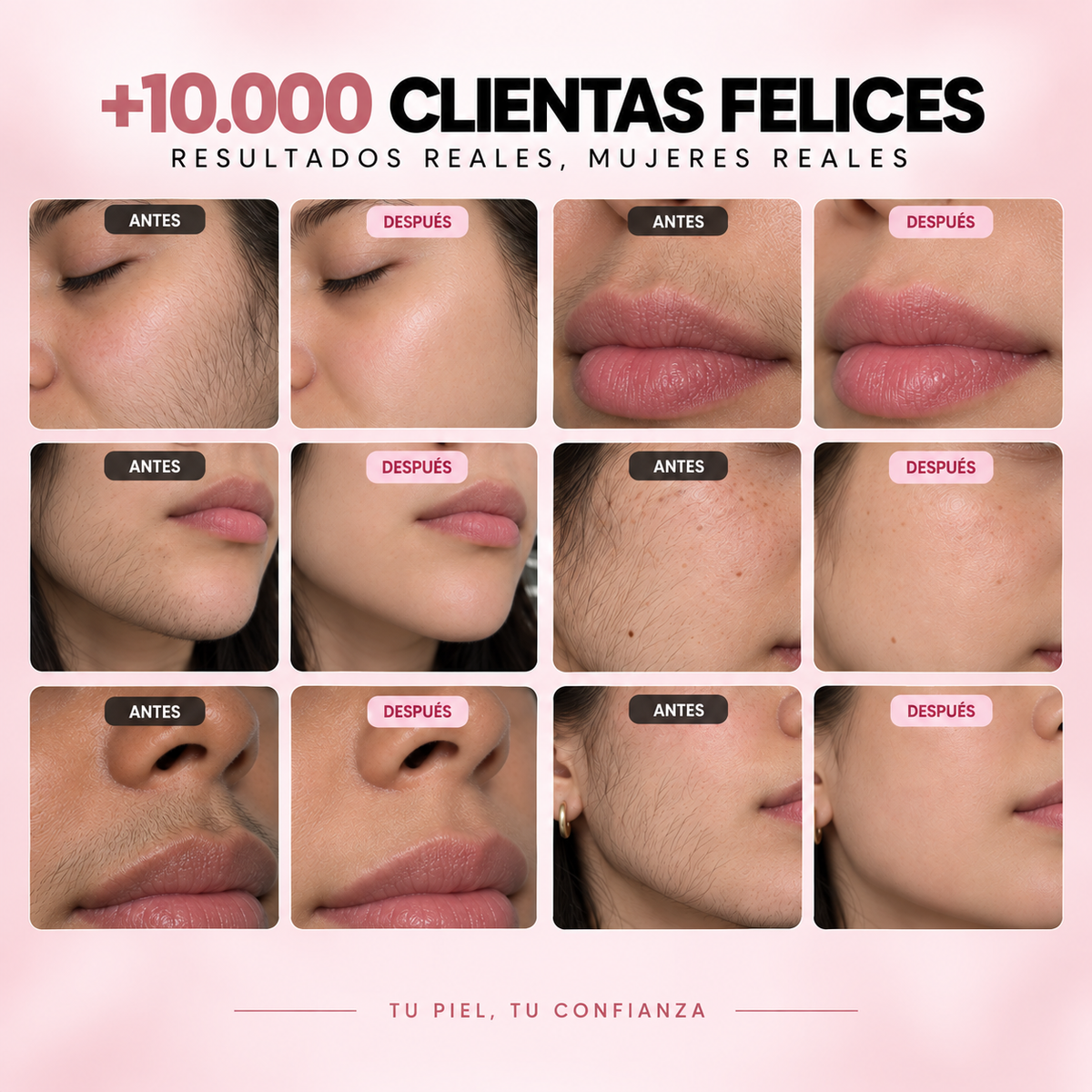 CORLEN beauty™ Kit Trilogía Depilación Facial 3 en 1