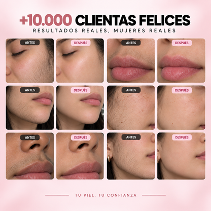 CORLEN beauty™ Kit Trilogía Depilación Facial 3 en 1